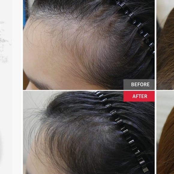 Vitabrid c12 Hair tonic set - Picture 3 of 7